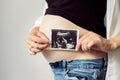 Pregnant woman holding ultrasound baby image. Pregnant belly and sonogram photo in hands of mother. Concept of pregnancy,