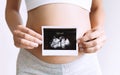 Pregnant woman holding ultrasound baby image Royalty Free Stock Photo