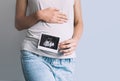 Pregnant woman holding ultrasound baby image