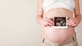 Pregnant woman holding an ultrasound scan Royalty Free Stock Photo