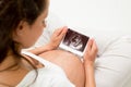 Pregnant woman looking at baby ultrasound scan