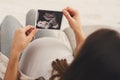 Pregnant woman looking at her baby sonography Royalty Free Stock Photo