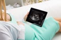 Pregnant woman looking at ultrasonography of her baby Royalty Free Stock Photo