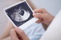 pregnant woman is looking at an ultrasound photo of fetus. Mother gently touches the baby on stomach. Happy, family, growth, Royalty Free Stock Photo