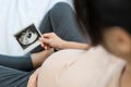 A pregnant woman is looking at an ultrasound photo of fetus. Mother gently touches the baby on stomach.Women are pregnant for 30 w Royalty Free Stock Photo