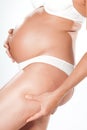 Pregnant woman pinching cellulite Royalty Free Stock Photo