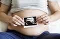 Pregnant woman showing fetus ultrasound photo Royalty Free Stock Photo