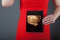 Pregnant woman showing ultrasound picture of the baby