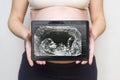 Pregnant woman shows a picture of a baby ultrasound scan on a tablet. Healthy pregnancy. Concept of Pregnancy health care