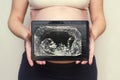 Pregnant woman shows a picture of a baby ultrasound scan on a tablet. Healthy pregnancy. Concept of Pregnancy health care