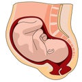 Pregnant womb anatomy close-up. pregnant woman with baby inside illustration on white background. Royalty Free Stock Photo