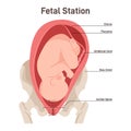 Prelabor position of the fetus in the uterus. Fetus movement during