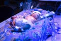 Premature Baby Royalty Free Stock Photo