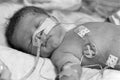 Premature Baby Royalty Free Stock Photo