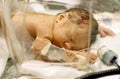 Premature Baby Royalty Free Stock Photo