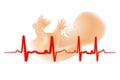 Premature Baby Fetus Electrocardiogram Royalty Free Stock Photo