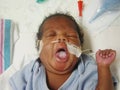 Premature Baby Taking A Yawn