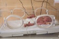 Premature newborn baby in the hospital incubator. Neonatal intensive care unit Royalty Free Stock Photo