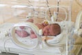 Premature newborn baby in the hospital incubator. Neonatal intensive care unit Royalty Free Stock Photo