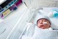 Pump and premature baby feeding in hospital Royalty Free Stock Photo