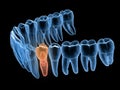 Premolar tooth recovery with implant, x-ray view. Medically accurate 3D illustration of human teeth and dentures
