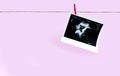 Prenatal ultrasound screening of unborn baby on pink background. Pregnancy concept.