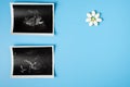 Prenatal vitamins, supplements and medications for healthy pregnancy concept. Image of baby in mother`s womb during ultrasound Royalty Free Stock Photo