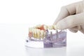 Preparation of dental prosthesis Royalty Free Stock Photo