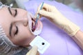Preparation of the oral cavity before professional teeth cleaning. The dentist applies a purple gel to the patient`s