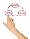 Cycle leading to PCOS Royalty Free Stock Photo