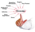 Eight Triggers of Fibromyalgia