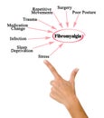 Eight Triggers of Fibromyalgia