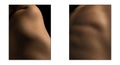 Preset with closeup images of part of female body. Detailed texture of human female skin. Skincare, bodycare, healthcare