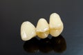 Pressed ceramic teeth