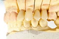 Pressed ceramic teeth Royalty Free Stock Photo