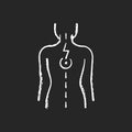 Pressure on spinal nerves chalk white icon on black background Royalty Free Stock Photo