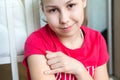 Preteen smiling girl portrait with BSG scar on her shoulder, showing place of vaccination with finger