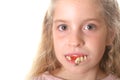 Pretty little girl with ugly teeth (copy space left) Royalty Free Stock Photo