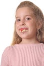 Pretty little girl with ugly teeth vertical Royalty Free Stock Photo