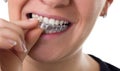 Preventive teeth braces Royalty Free Stock Photo