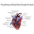 Heart anatomy and types of heart disease vector illustration