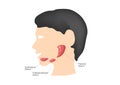 Salivary glands sublingual , submandibular and parotid gland - Vector