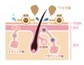 Cause of body odor vector illustration / japanese