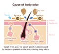 Cause of body odor vector illustration / english