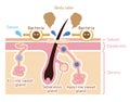 Cause of body odor vector illustration / english