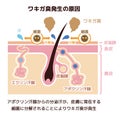 Cause of body odor vector illustration / japanese