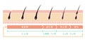 Normal hair cycle illustration