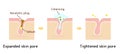 Structure illustration of pores cleansing / English