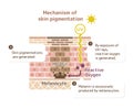 Mechanism of skin pigmentation illustration