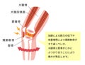 Mechanism and causes of knee joint pain / Japanese